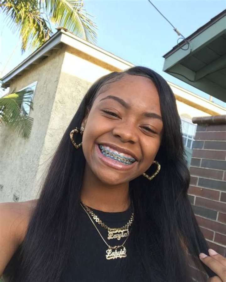 Brace Face Laii with Anayah Rice Brace Face Laii with Anayah Rice